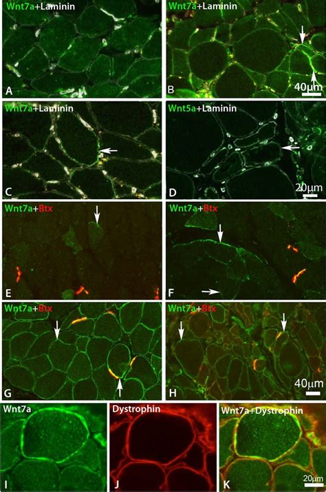 Wnt Immunostaining At Myofiber Peripheries In Human Adult A And ALS