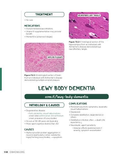 Lewy body dementia | Osmosis