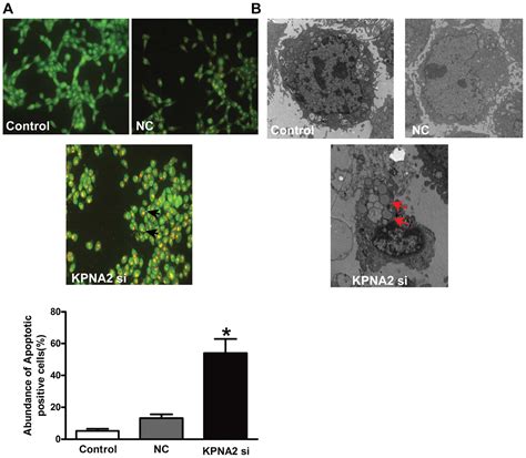 Karyopherin Induces Apoptosis In Tongue Squamous Cell Carcinoma Cal