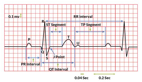 ?PQRST Explained? A Great Memory Knowledge Of ECG Facebook, 48% OFF