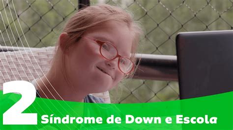 S Ndrome De Down Inclus O Escolar A S Ndrome De Down Uma