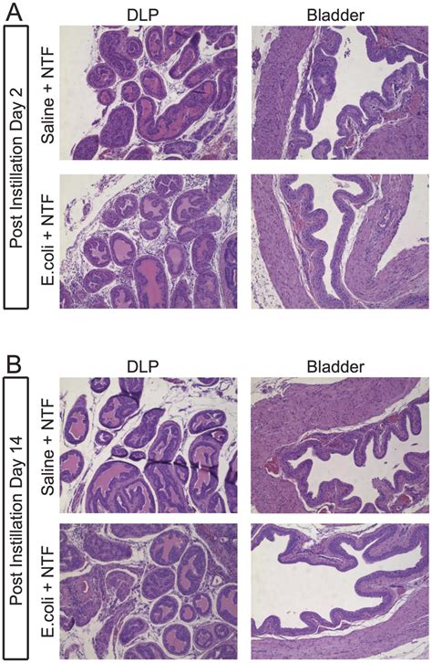 E Coli Induced Prostatic Inflammation Representative H E Stained