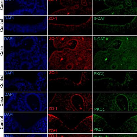 Confocal Analysis Performed After Double Immunostaining On Sections Of