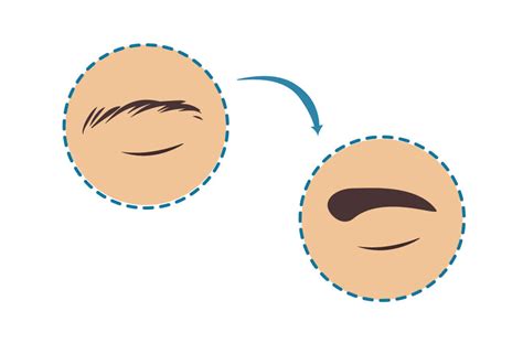 Injerto de Cejas en México Información y procedimiento