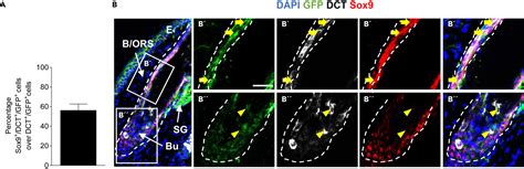 Sox Regulates Melanocytic Fate Decision Of Adult Hair Follicle Stem