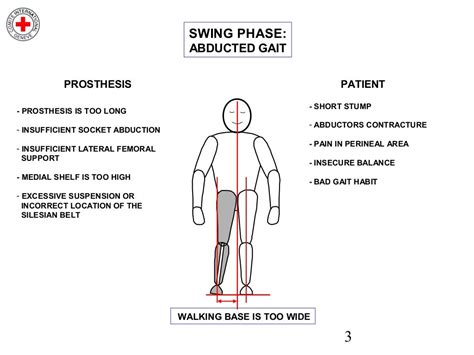 Transfemoral Gait Deviations