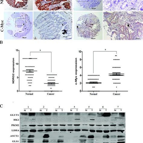 The Expression Analysis Of Ndrg And Metabolism Related Molecules In