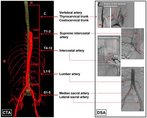 Sacral Artery