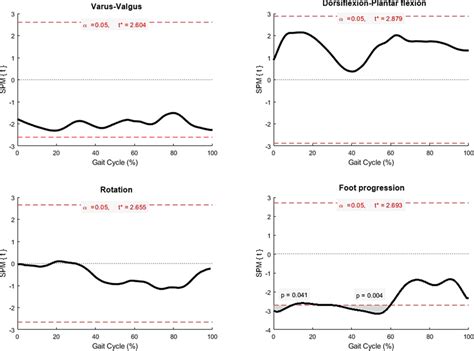 Statistical Parametric Mapping SPM Comparing Ankle Kinematics Between