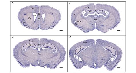 The Expression Pattern Of Adam In The Central Nervous System Of Adult