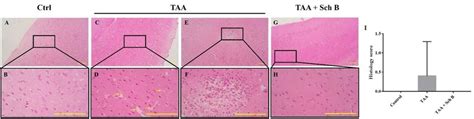 Histopathology of the brain. (A and B) Representative photomicrographs ... 
