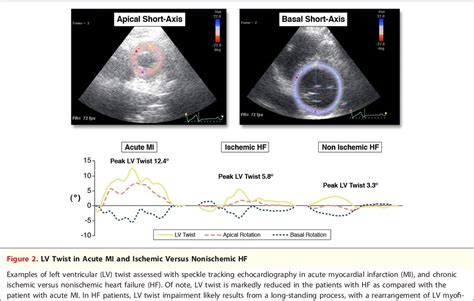 Figure 2 From Role Of Left Ventricular Twist Mechanics In The