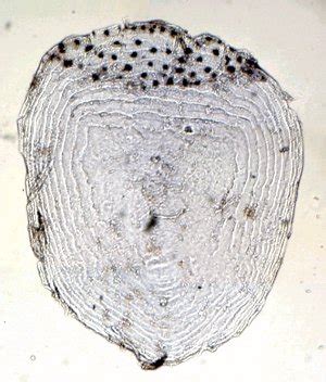 Ctenoid Scales : Cycloid scales - Elasmoid, ctenoid and cycloid scales ...