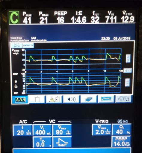 American Thoracic Society - ATS Quick Hits