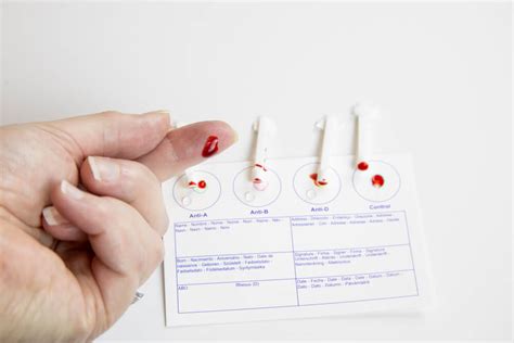 Blood Typing From Home Using The Eldoncard Blood Type Test Kit