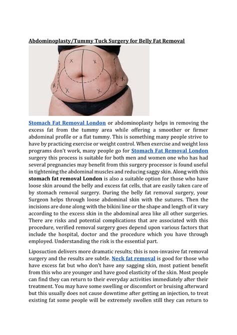 PPT Abdominoplasty Tummy Tuck Surgery For Belly Fat Removal