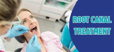 Cost Of Root Canal Treatment With And Without Insurance