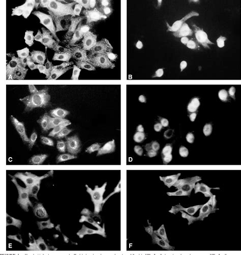 Figure From Helicobacter Pylori Infection Interferes With Epithelial