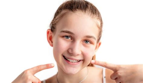 How To Fix A Narrow Smile Can Braces Or Invisalign Help