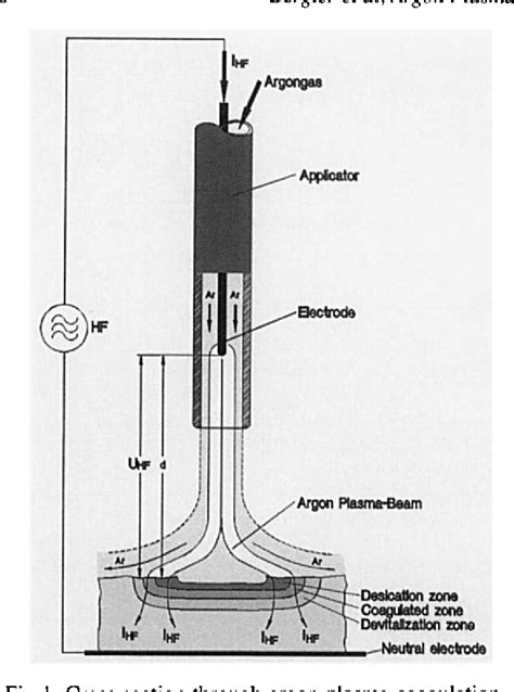 Figure From Argon Plasma Coagulation For Inferior Turbinate Reduction