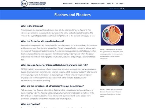 Flashes And Floaters Retina Vitreous Surgeons Of Cny