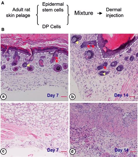 Dermal Papillae Histology