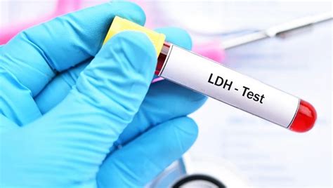 Ldh Alto O Que Significa - LDH alto: qué significa, causas y tratamiento - eSalud