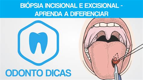 Roteiro Bi Psia Odontologia Cirurgia Buco Maxilo Facial