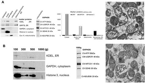 Isolation Of Pure Mitochondria From Rat Kidneys And Western Blot Of