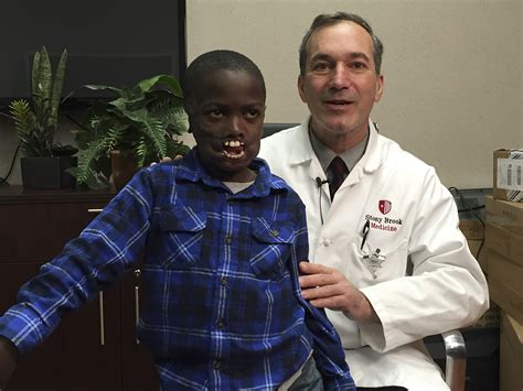 Congolese boy, 8, who lost lips in deadly chimp attack to get rare