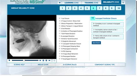 Laryngeal Vestibule Closure