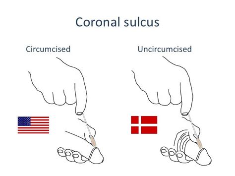 Circumcised And Uncircumcised Diagram Explains How Foreskins