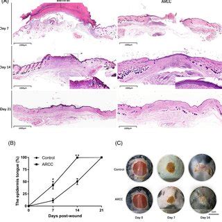 Histological Observation Of Wound Healing On Mice 1618w On Day 7 14