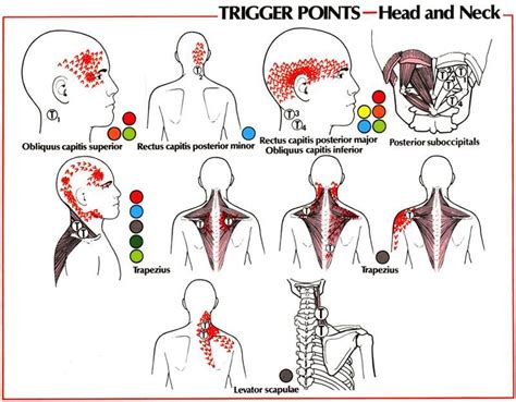 Head And Neck Trigger Points Trigger Points Neuromuscular Therapy