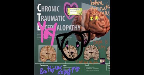 NICKI MINAJ PORN Feat Sushi Kardashian Kuma Single Album By JJK FAM Apple Music