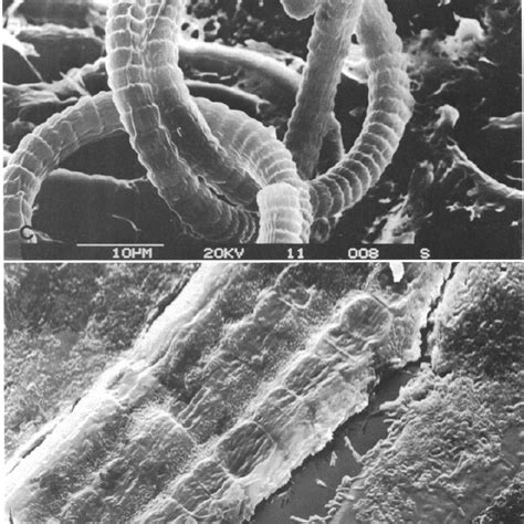 Microscopic View Of Microalgae Spirulina Cyanobacteria Photo By E