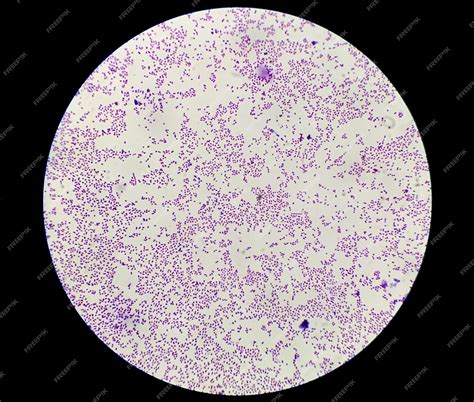 Staphylococcus Aureus Gram Stain 100X