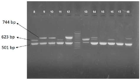 Figure 2 From Development Of Multiplex PCR For Rapid Detection Of