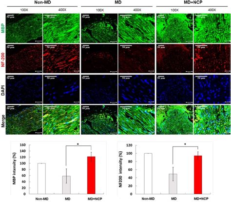 Immunofluorescence In Neural Tissue And Mbp And Nf Intensity In