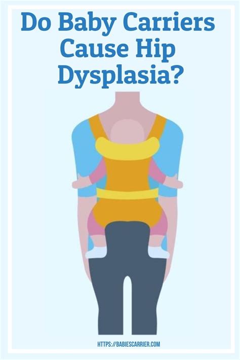 Infant Hip Dysplasia Do Baby Carriers Cause Hip Dysplasia Hip