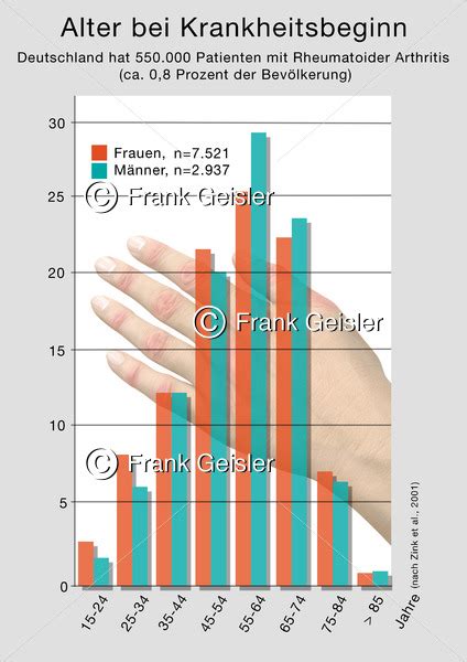 Rheumatoide Arthritis Bei Frauen Und M Nner In Deutschland Medical