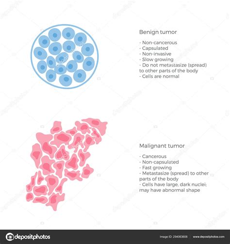 Benign Vs Malignant Cells