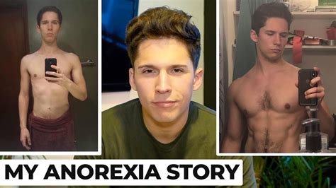 My Anorexia Story Full Recovery L Male Eating Disorders Youtube