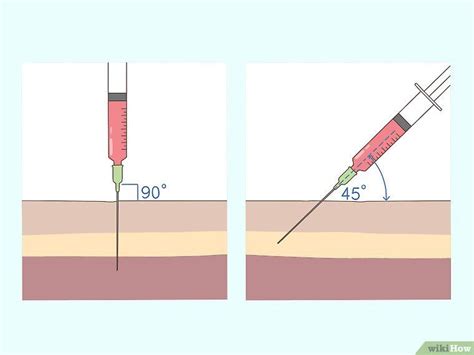 How To Give A B12 Intramuscular Injection TheJournalismGroup