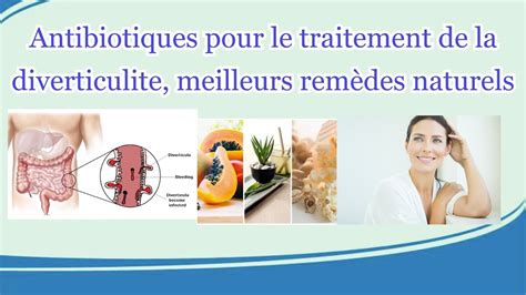 Antibiotiques Pour Le Traitement De La Diverticulite Meilleurs Rem Des