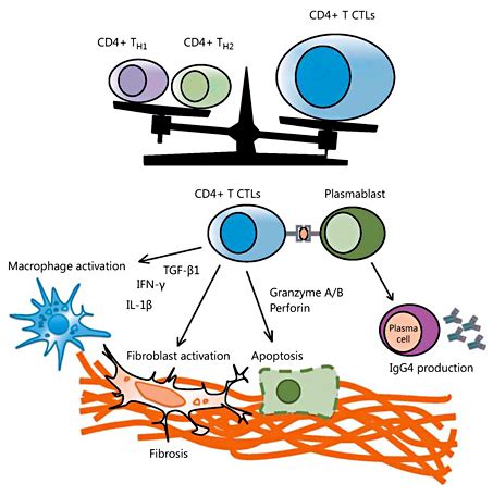 Immunoglobulin G Related Thyroid Diseases In European Thyroid Journal