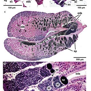 Histological Sections Of X Eiseni Testes Showing The Different Stages