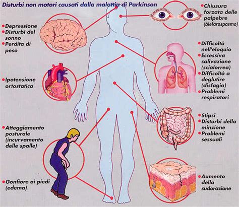 Problemi Non Motori Parkinsonitalia It