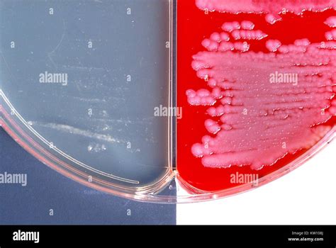 Micrografia luz bacillus subtilis fotografías e imágenes de alta