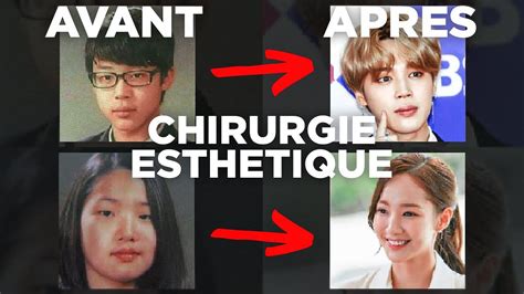 LA CHIRURGIE ESTHÉTIQUE CHEZ LES IDOLS DE KPOP ET ACTEURS CORÉENS YouTube